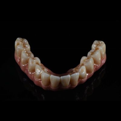 Kalite  Fixed Restorations Full Arch Zirconia Implant Bridge Denture Teeth Fabrika